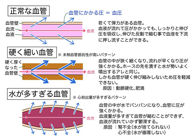 様々な血管で起こる弊害