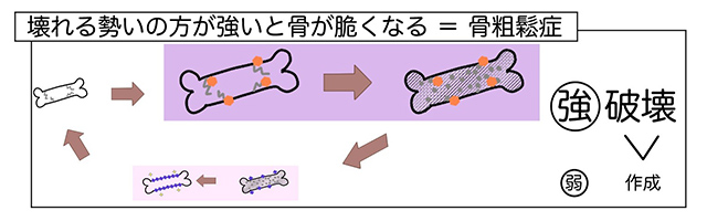 骨粗鬆症の仕組み